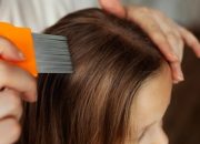 7 Cara Mengatasi Kutu Rambut Beserta Telurnya, Efektif dan Cepat Hilang