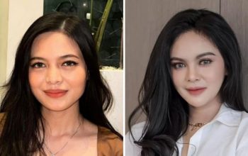 3 Potret Transformasi Vanessa Nabila dan Clara Wirianda, Dicurigai Jalani Operasi Kecantikan